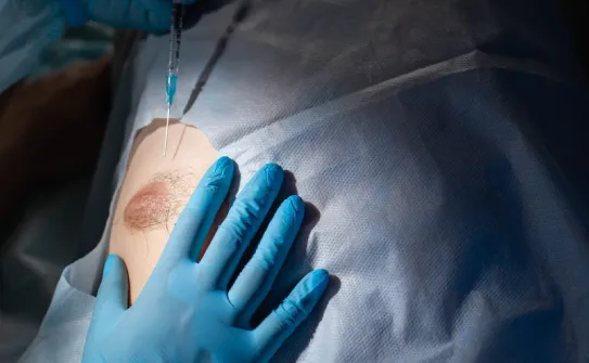 乳腺切除-台北大安男性女乳症手術