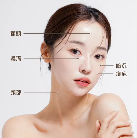 喬雅露JUVELOOK常見施打部位-台北水光針推薦