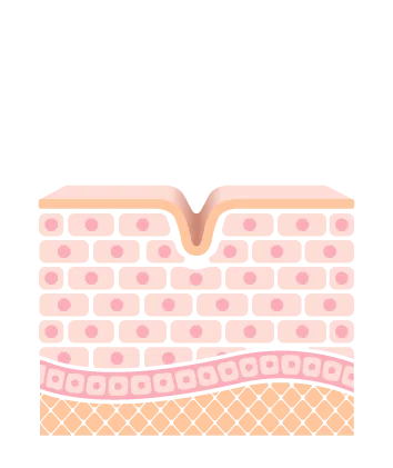 喬雅露作用原理-未注射-台北大安東區水光針推薦