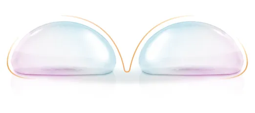 適合對象-台北大安女王波