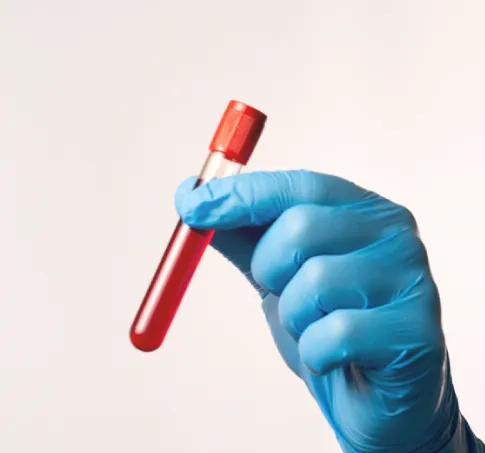 術前檢測-台北隆乳推薦