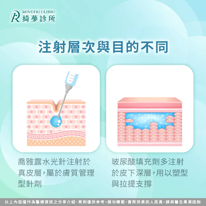 注射層次-喬雅露水光針與玻尿酸有什麼不同