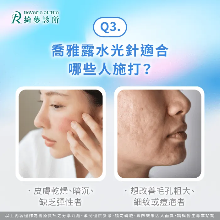 喬雅露水光針適合對象-什麼是喬雅露水光針